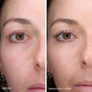 CS Total Eye 3in1 Treatment